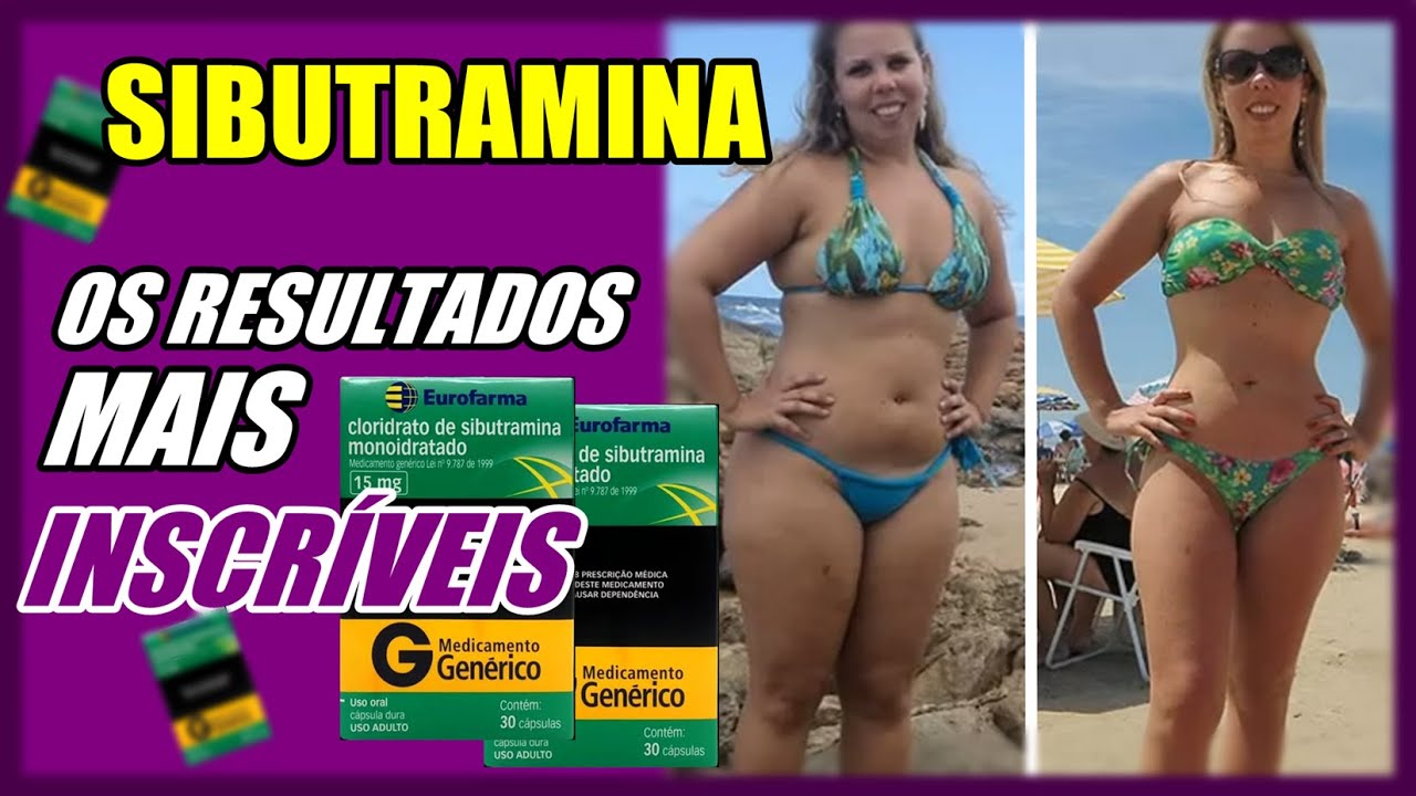 SIBUTRAMINA | Os 5 ANTES E DEPOIS mais INCRÍVEIS da internet ...