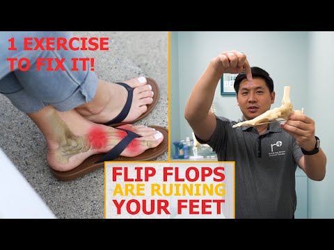 वीडियो: फ्लिप फ्लॉप को अपने पैरों को चोट पहुंचाने से रोकने के 3 तरीके