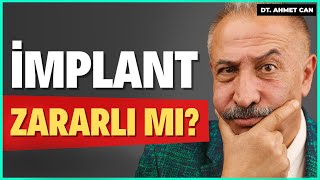 İMPLANT TEDAVİSİ...En Çok Sorulan 10 Soru ! - Dt. Ahmet Can Ertüz