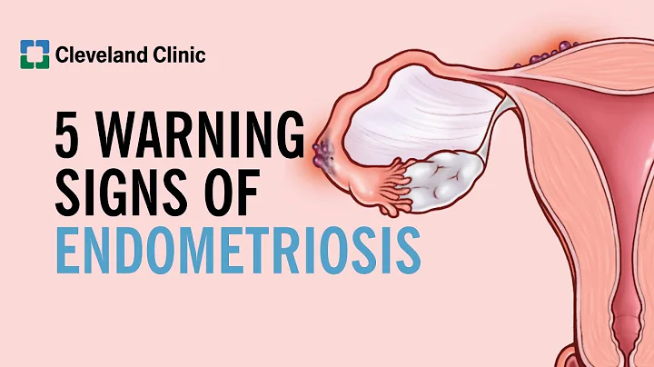 5 Warning Signs of Endometriosis
