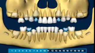 Cronologia de irrupção dos dentes