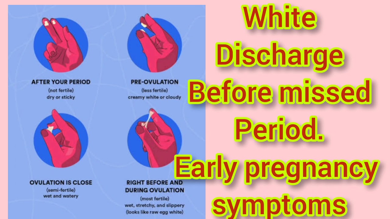 Early pregnancy symptoms before missed Period white discharge before