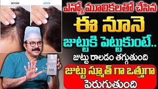 Best Solution For Hair Fall | Prismos Products | Fallcure Hair Oil | Sriroop Cosmetics Clinic