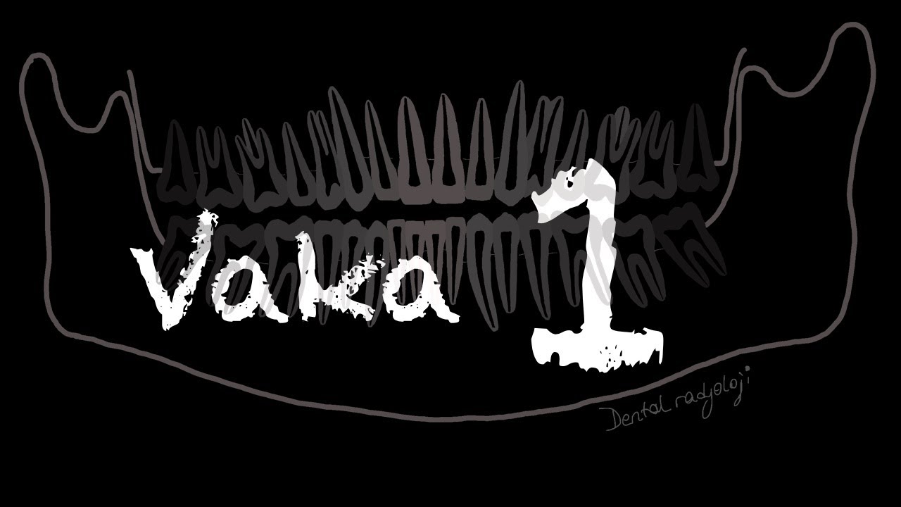 DENTAL RADYOLOJİ VAKA 1