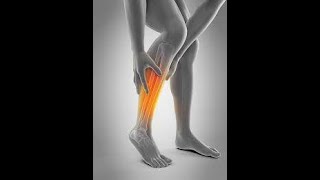 Dolor De Espinilla Causado Por Periosis Dolor De Piernas Causado Por Periosis