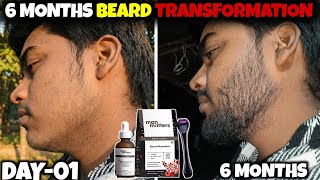 Man Matters Beard Kit 6 Months Result | man matters beard growth kit review | minoxidil beard growth screenshot 1