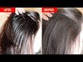 REMEDIO CASERO PARA CABELLO GRASO