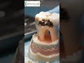 Wonderful Dentists Restoration! Dr sila #satisfying