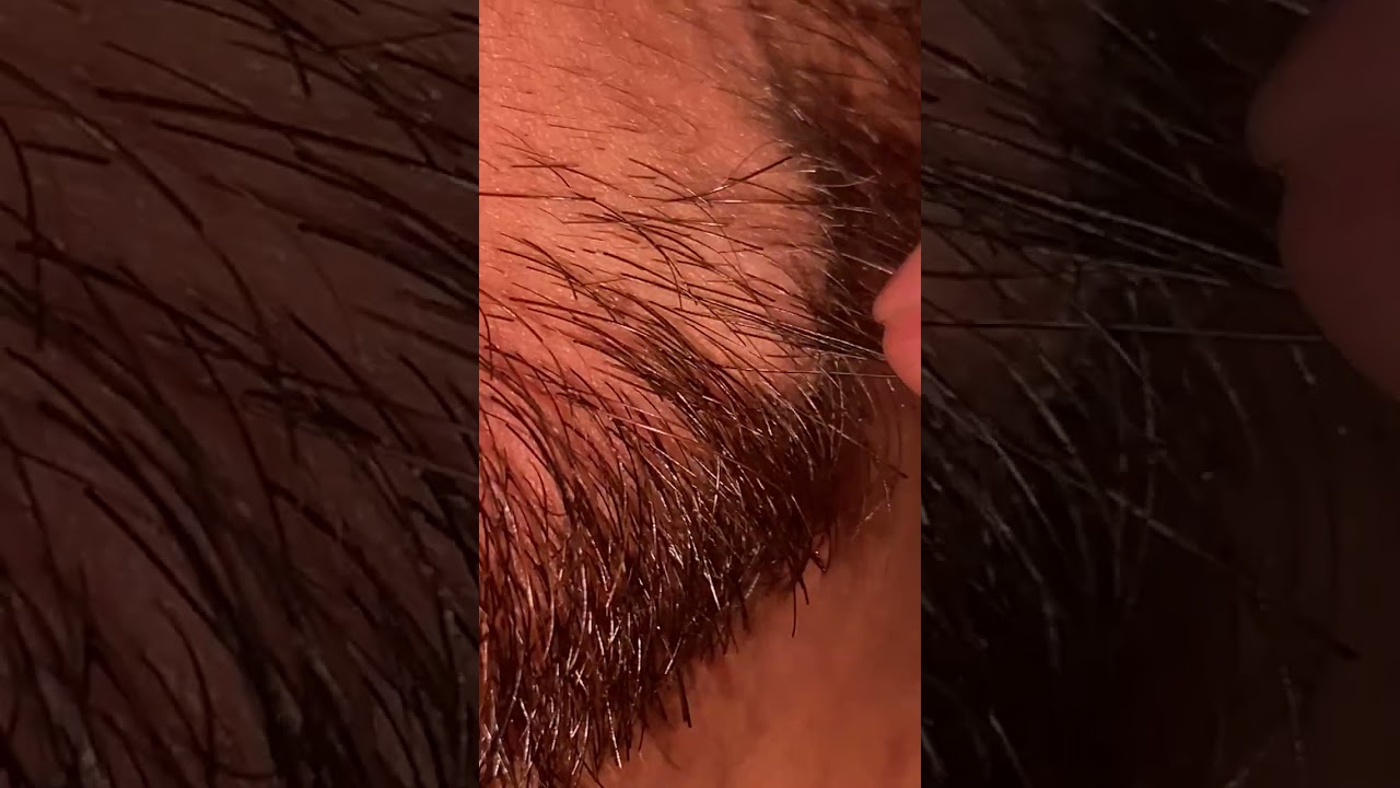 ASMR ingrown satisfying hair video haircut hair style hair massage 