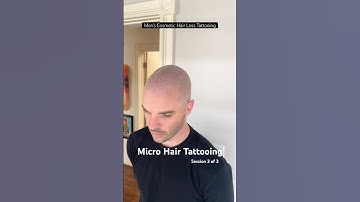 Men’s Micro Hair Tattooing - Scalp Micropigmentation #smp #scalpmicropigmentation