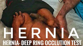 Hernia examination | Deep ring occlution test | Hello season 2