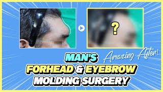 For Gentle Man's soft image Eyebrowbone Shaping screenshot 5
