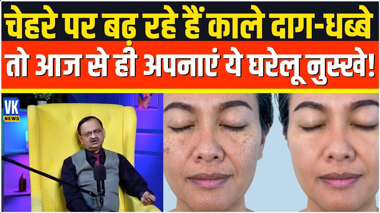चेहरे पर बढ़ रहे हैं काले दाग-धब्बे, तो आज से ही अपनाएं ये घरेलू नुस्खे! Subhash Goyal |📞8283060000