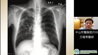 肺實質化病變與肺塌陷 王耀東醫師 台灣胸腔暨重症加護醫學會