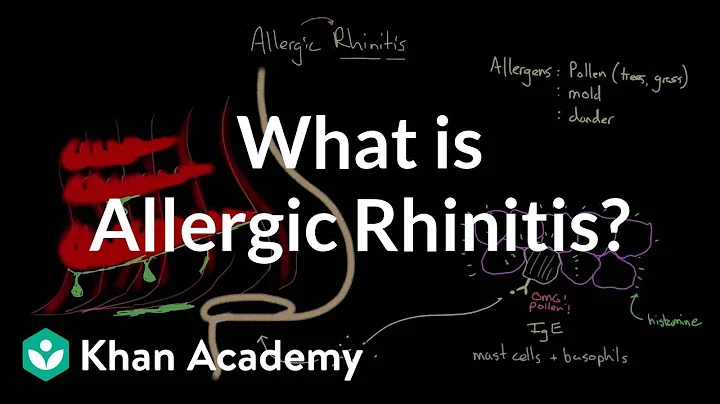 What is allergic rhinitis? | Respiratory system diseases | NCLEX-RN | Khan Academy - DayDayNews