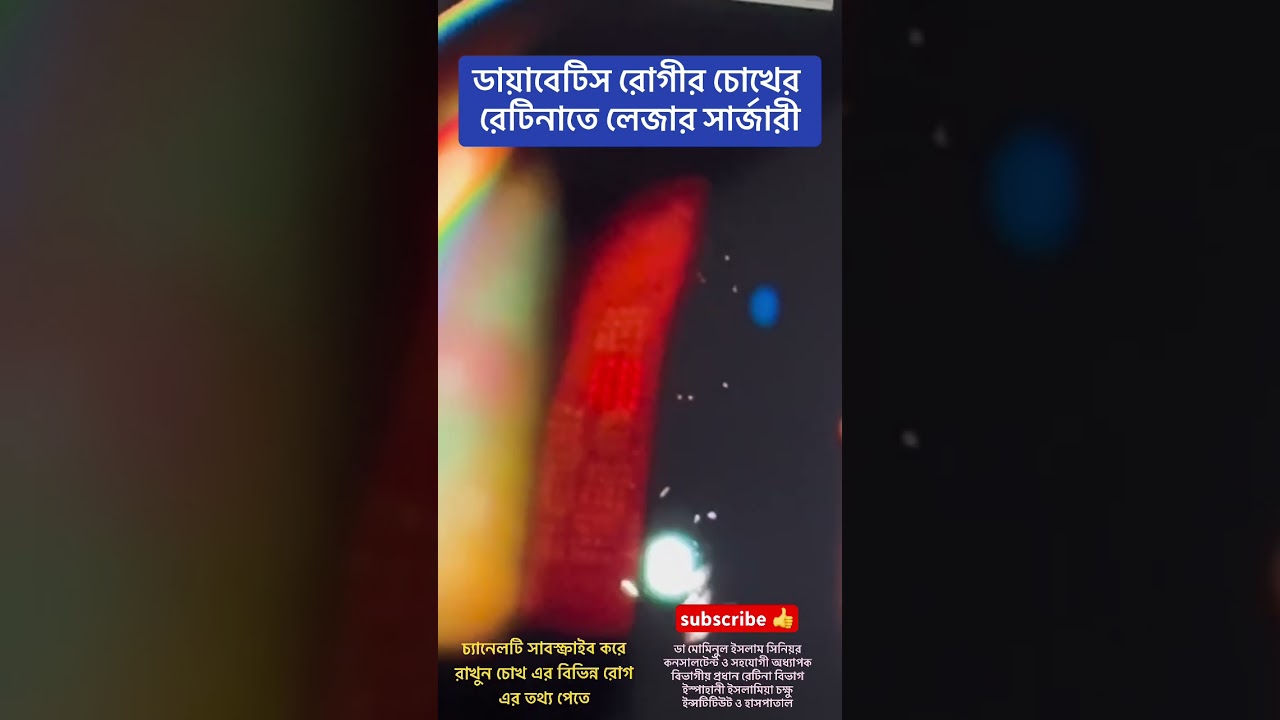 Diabetic retinopathy Laser surgery! ডায়াবেটিস রোগীর চোখে লেজার #diabeticretinopathy #eyecare #চশমা