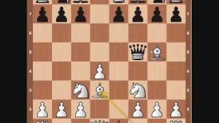 Chess Basics: Queen Overview
