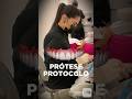 Deu bom! 🤩 Novo Sorriso Fixo #Protocolo Implante | Reação da Paciente!