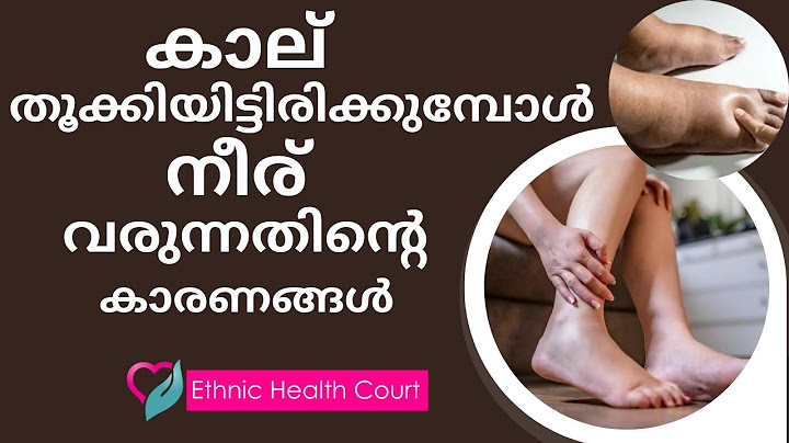 കാൽ തൂക്കിയിട്ട് ഇരിക്കുമ്പോൾ നീര് വരുന്നത് എന്ത്കൊണ്ട് | Ethnic Health Court