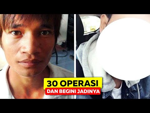 Video: Kecantikan Pria: Selebriti Pria Yang Menjalani Operasi Plastik