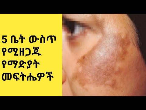 ቪዲዮ: ለምን ከመቆጣጠሪያው ፊት ለፊት Cacti ለምን አስቀመጠ?