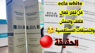 كريم ecla white هل فعال لعلاج الكلف والتصبغات المستعصية وتفتيح البشرة ؟?