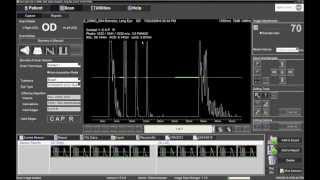 Performing IOL Calculations with the Ellex Eye Cubed