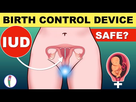 Video: Ano ang contraceptive coils?