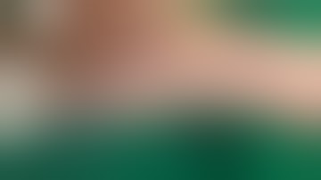 Technique of percutaneous fixation of scaphoid with headless compression screw @bipinhandsurgeon