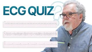 ECG Quiz: Improve Your ECG Skills