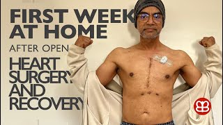 First Week At Home After Hospital | Open Heart Surgery and Recovery | Aortic Valve Repair & CABG