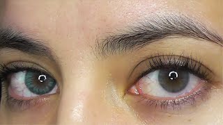 Siesta Iris Blue Vs Siesta Halo Sky Color Contact Comparison