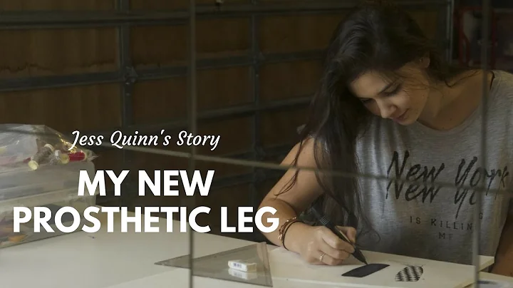 My New Prosthetic Leg: Jess Quinn