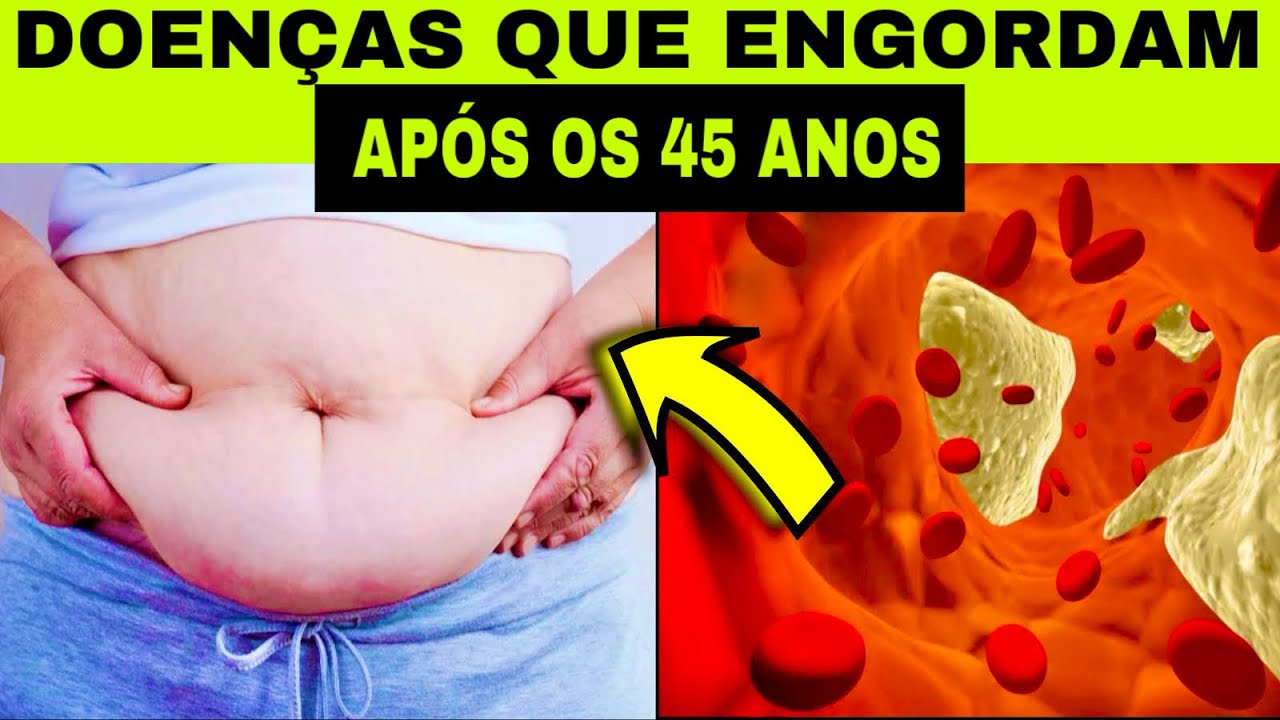 8 DOENÇAS que ENGORDAM APÓS os 45 ANOS - YouTube