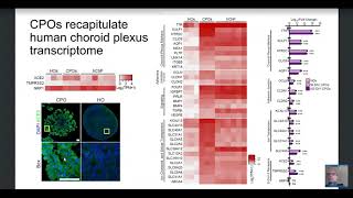Fadi Jacob – Human pluripotent stem cell-derived neural cells and brain organoids reveal SARS-CoV-2