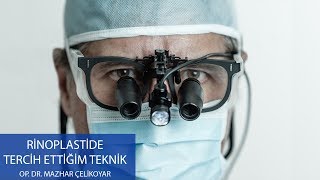 Bir Hekim Olarak Rinoplastide Hangi Tekniği Tercih Ediyorsunuz? - Op. Dr. Mazhar Çelikoyar