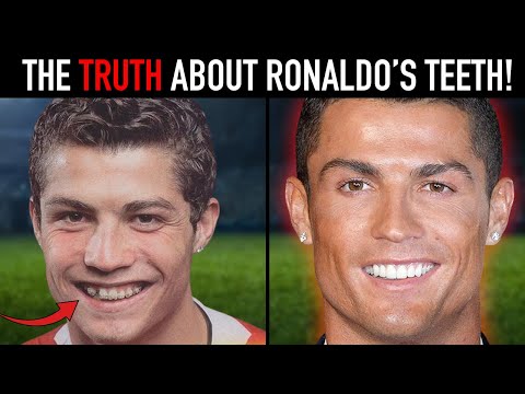 Cristiano Ronaldo Amazing Teeth Transformation - Whats the secret?