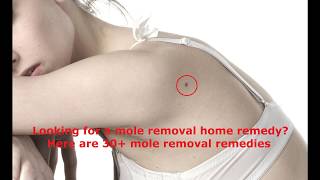 Looking for a mole removal home remedie? Here are 30+ examples of a mole removal home remedie