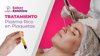 Platelet-Rich Plasma Step by Step 💉 | Professional Technique Explained | SaberEstética