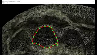 tooth auto margin detection