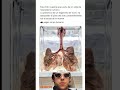 Esta foto muestra gran parte de un sistema respiratorio humano #shorts