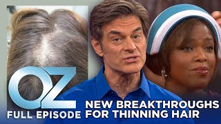 Dr. Oz | S7 | Ep 9 | New Breakthroughs for Thinning Hair | Full Episode