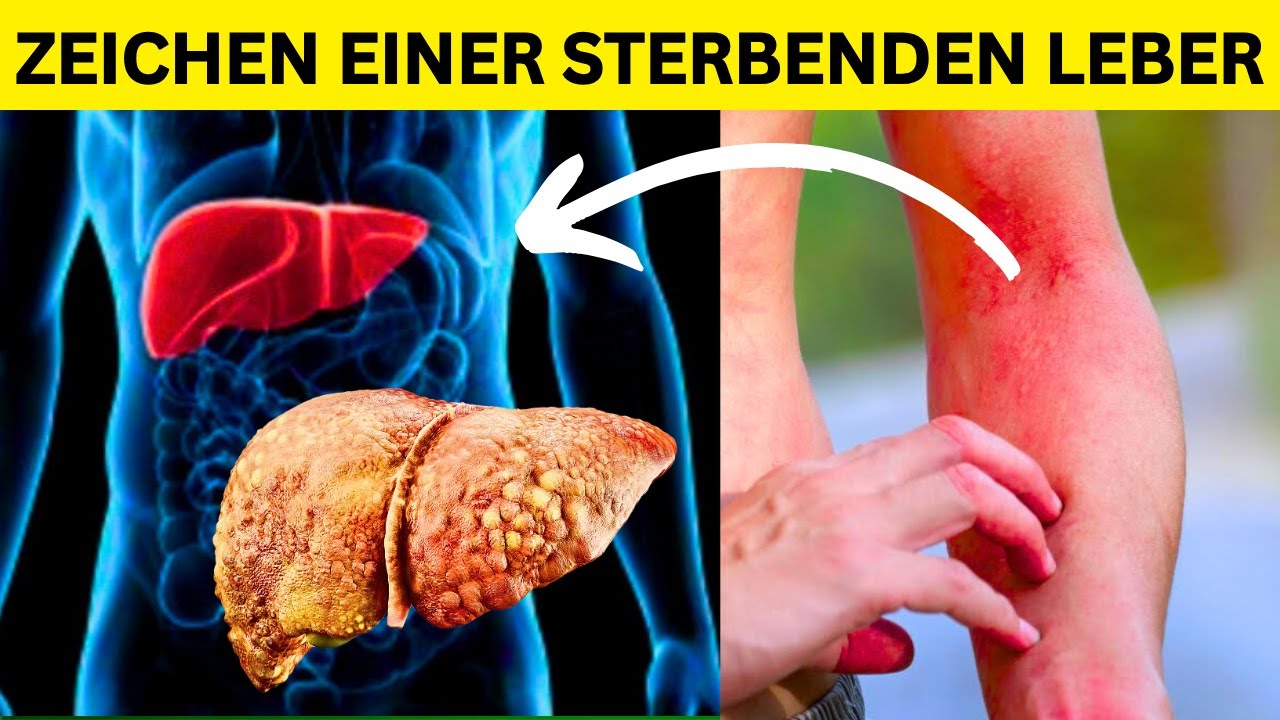 Wie Machen Sich Leberprobleme Bemerkbar www.youtube.com
