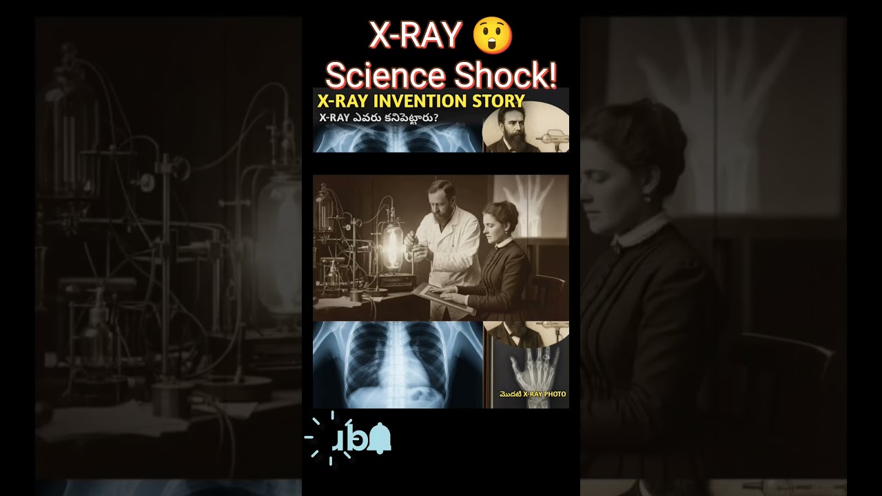 . X-Ray ఎవరు కనుగొన్నారు? 😲 | X-Ray Invention Story in Telugu