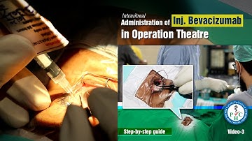 Intravitreal administration of the Inj Bevacizumab in operation theatre