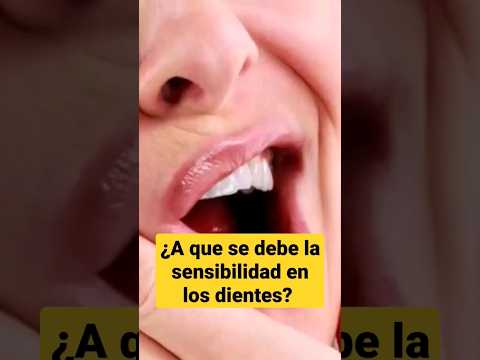 ¿A que se