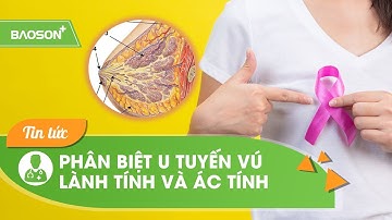 4 điểm phân biệt u tuyến vú lành tính & ác tính | Bệnh Viện Đa Khoa Bảo Sơn