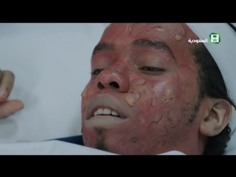 شكش وكفته يصبوا على أنفسهم مياه مغلية || شباب البومب