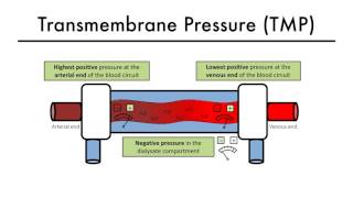 Hemodialysis Kinetics 101 05 Transmembrane Pressure
