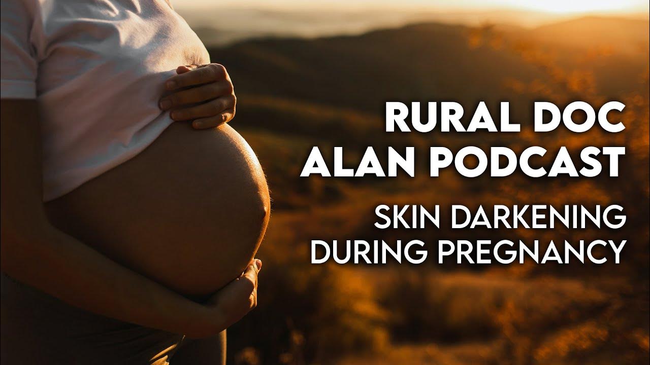skin-darkening-during-pregnancy-rural-doc-alan-podcast-youtube